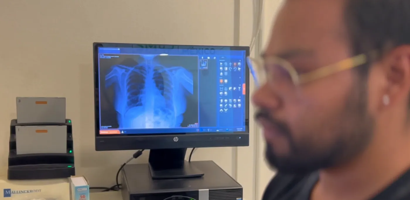 Técnico radiólogo revisando una radiografía de tórax